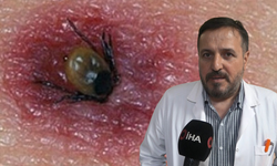 Havalar ısındı, kene vakaları hastanelere gelmeye başladı