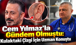Kulak memesindeki çizgiye dikkat:“Vücudun bir sinyali”