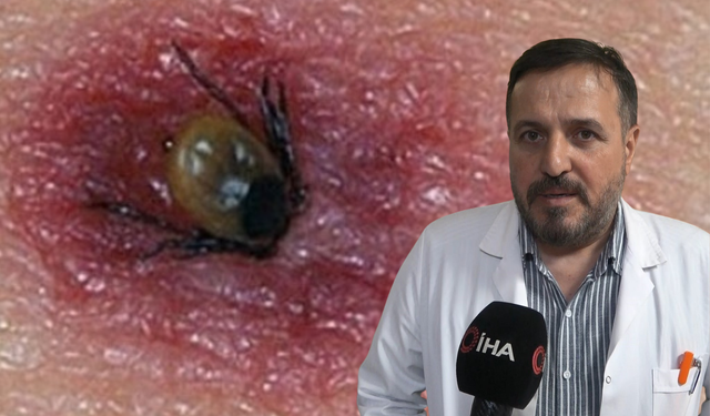 Havalar ısındı, kene vakaları hastanelere gelmeye başladı