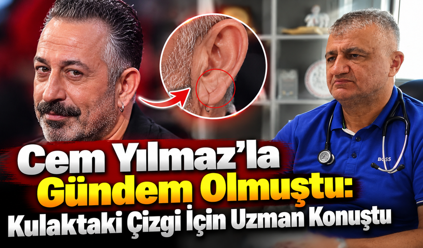 Kulak memesindeki çizgiye dikkat:“Vücudun bir sinyali”