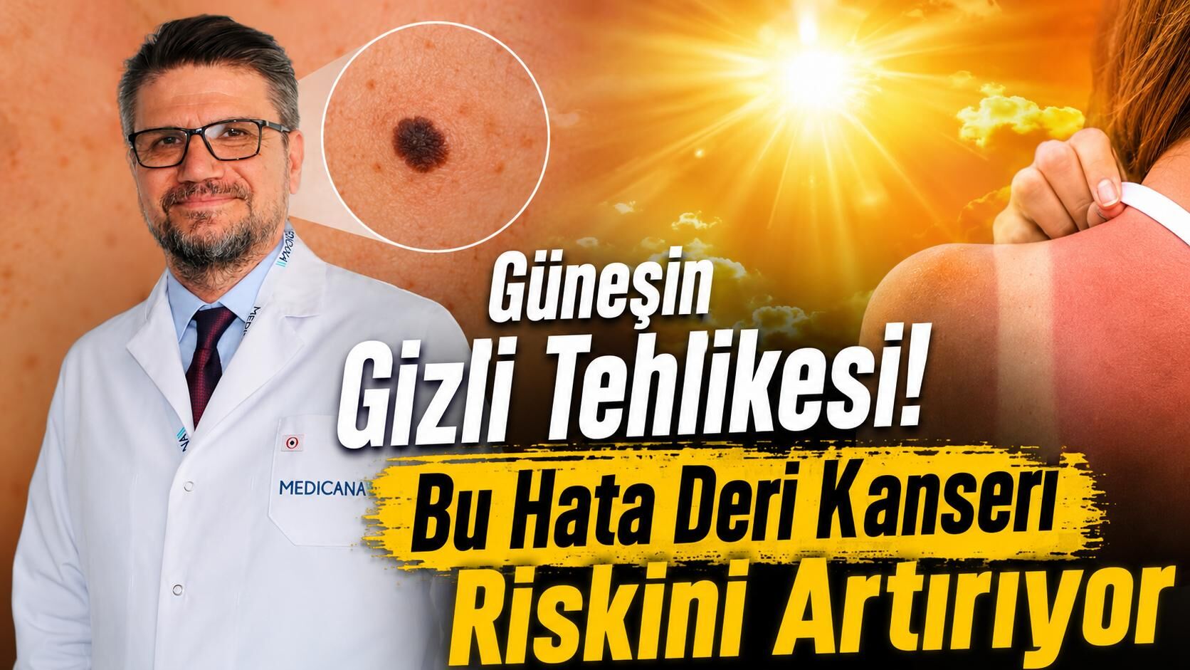 "Güneş kremine güvenip hu hatayı yapmayın! Uzmandan deri kanseri uyarısı"
